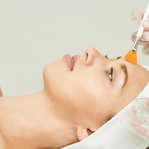 3 sesiones de peeling