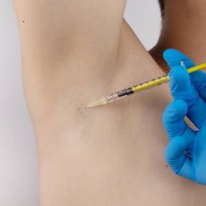 Botox hiperhidrosis axilas + Sesión Radiofrecuencia Fraccionada