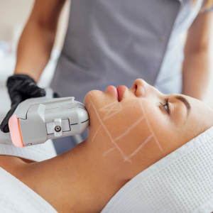 10 sesiones de prosculpt 4 sesiones de lipoenzimas 4 radiofrecuencia